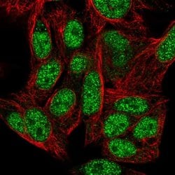 Invitrogen ZNF556 Polyclonal Antibody 100 &mu;L; Unconjugated:Antibodies,