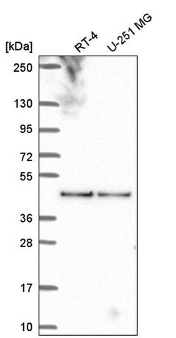 Invitrogen C17orf59 Polyclonal Antibody 100 &mu;L | Buy Online | Invitrogen&trade; | Fisher Scientific