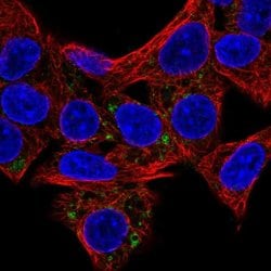 HSD3B7 Polyclonal Antibody:Antibodies, Polyclonal