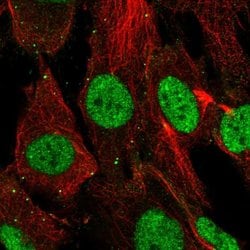 Invitrogen SHOX Polyclonal Antibody 100 &mu;L; Unconjugated:Antibodies,