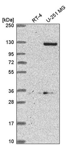 Invitrogen DSEL Polyclonal Antibody 100 &mu;L; Unconjugated:Antibodies,
