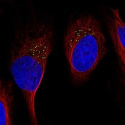 Invitrogen GDF11 Polyclonal Antibody 100 &mu;L; Unconjugated:Antibodies,