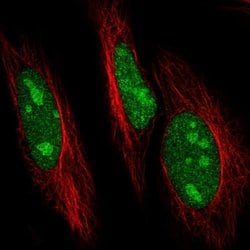 Invitrogen UBC3B Polyclonal Antibody 100 &mu;L; Unconjugated:Antibodies,