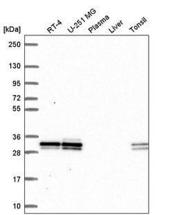 Invitrogen UBC3B Polyclonal Antibody 100 &mu;L; Unconjugated:Antibodies,