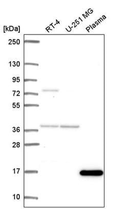 Invitrogen FOXL2NB Polyclonal Antibody 100 &mu;L; Unconjugated:Antibodies,