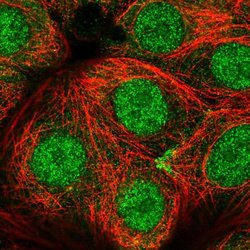 Invitrogen CCDC64 Polyclonal Antibody 100 &mu;L; Unconjugated:Antibodies,