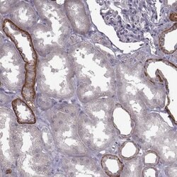 Invitrogen CCDC64 Polyclonal Antibody 100 &mu;L; Unconjugated:Antibodies,