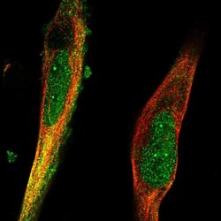Invitrogen TRIM36 Polyclonal Antibody 100 &mu;L; Unconjugated:Antibodies,