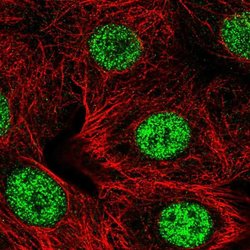 Invitrogen SMARCD2 Polyclonal Antibody 100 &mu;L; Unconjugated:Antibodies,