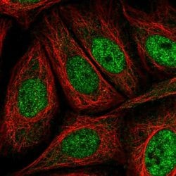Invitrogen AKIP1 Polyclonal Antibody 100 &mu;L; Unconjugated:Antibodies,