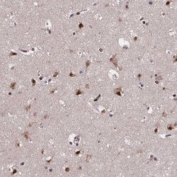 SR140 Polyclonal Antibody, Invitrogen 100 &mu;L; Unconjugated:Antibodies,
