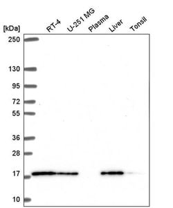Invitrogen TMEM230 Polyclonal Antibody 100 &mu;L; Unconjugated:Antibodies,