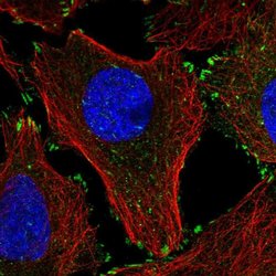 Invitrogen LPXN Polyclonal Antibody 100 &mu;L | Buy Online | Invitrogen&trade; | Fisher Scientific