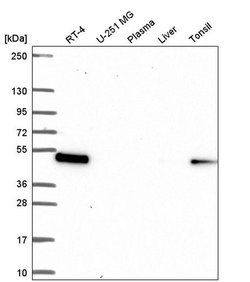 Invitrogen LPXN Polyclonal Antibody 100 &mu;L | Buy Online | Invitrogen&trade; | Fisher Scientific