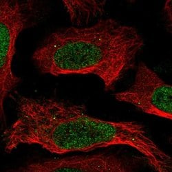 Invitrogen CREB5 Polyclonal Antibody 100 &mu;L; Unconjugated:Antibodies,