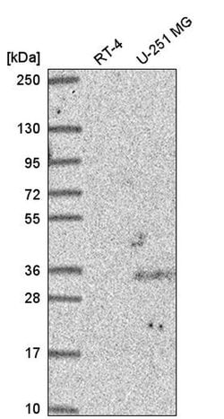 Invitrogen CREB5 Polyclonal Antibody 100 &mu;L; Unconjugated:Antibodies,