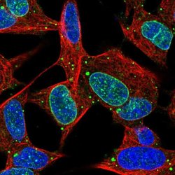 Invitrogen KIAA1614 Polyclonal Antibody 100 &mu;L; Unconjugated:Antibodies,