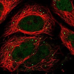 Invitrogen RPRD2 Polyclonal Antibody 100 &mu;L; Unconjugated:Antibodies,