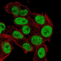 Invitrogen TRIM24 Polyclonal Antibody 100 &mu;L; Unconjugated:Antibodies,