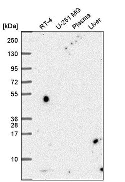Invitrogen PCBD1 Polyclonal Antibody 100 &mu;L; Unconjugated:Antibodies,