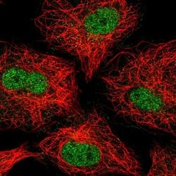 Invitrogen ZNF618 Polyclonal Antibody 100 &mu;L; Unconjugated:Antibodies,