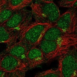 Invitrogen ASB13 Polyclonal Antibody 100 &mu;L; Unconjugated:Antibodies,