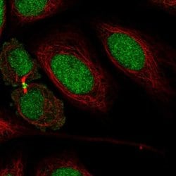 Invitrogen KIAA1143 Polyclonal Antibody 100 &mu;L; Unconjugated:Antibodies,