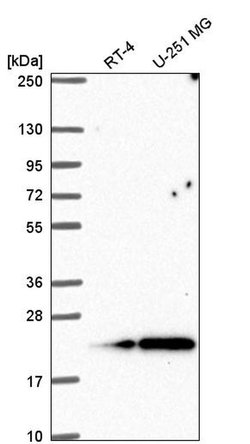 Invitrogen KIAA1143 Polyclonal Antibody 100 &mu;L; Unconjugated:Antibodies,