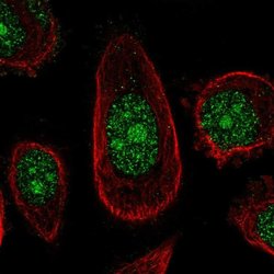Invitrogen ZNF16 Polyclonal Antibody 100 &mu;L; Unconjugated:Antibodies,