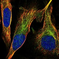 Invitrogen SLC37A3 Polyclonal Antibody 100 &mu;L; Unconjugated:Antibodies,