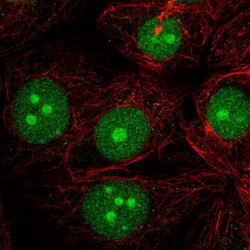Invitrogen LDOC1 Polyclonal Antibody 100 &mu;L; Unconjugated:Antibodies,