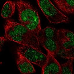 Invitrogen FAM204A Polyclonal Antibody 100 &mu;L; Unconjugated:Antibodies,