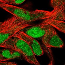 Invitrogen SLFN11 Polyclonal Antibody 100 &mu;L; Unconjugated:Antibodies,