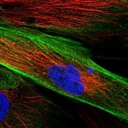 Invitrogen FAM167B Polyclonal Antibody 100 &mu;L; Unconjugated:Antibodies,