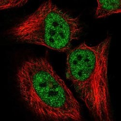 Invitrogen CDKN2AIP Polyclonal Antibody 100 &mu;L; Unconjugated:Antibodies,