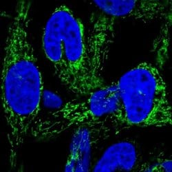 Invitrogen HEATR6 Polyclonal Antibody 100 &mu;L; Unconjugated:Antibodies,