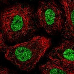 Invitrogen TGIF Polyclonal Antibody 100 &mu;L; Unconjugated:Antibodies,