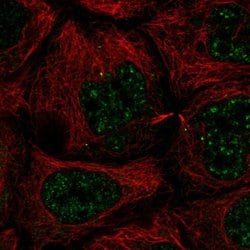 Invitrogen SLC35A4 Polyclonal Antibody 100 &mu;L; Unconjugated:Antibodies,