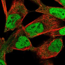 Invitrogen PIP4K2B Polyclonal Antibody 100 &mu;L; Unconjugated:Antibodies,