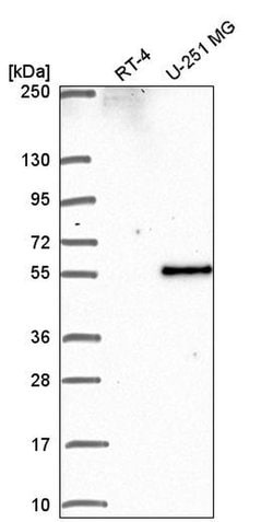 Invitrogen PIP4K2B Polyclonal Antibody 100 &mu;L; Unconjugated:Antibodies,
