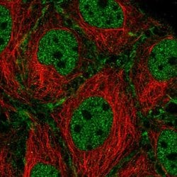 Invitrogen SYCP2 Polyclonal Antibody 100 &mu;L; Unconjugated:Antibodies,