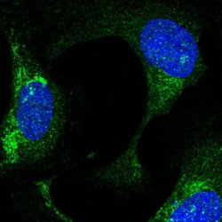 Invitrogen FBXO21 Polyclonal Antibody 100 &mu;L; Unconjugated:Antibodies,