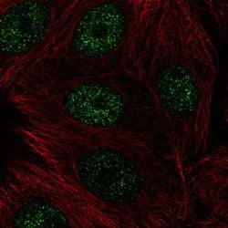 MTG16 Polyclonal Antibody:Antibodies, Polyclonal