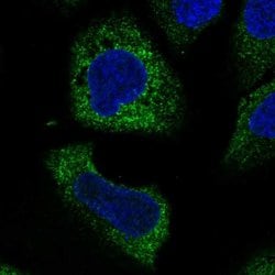 Invitrogen WISP3 Polyclonal Antibody 100 &mu;L; Unconjugated:Antibodies,