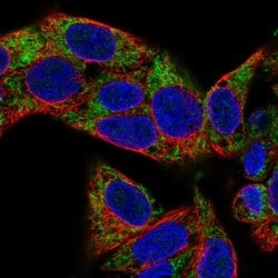 Invitrogen VARS2 Polyclonal Antibody 100 &mu;L; Unconjugated:Antibodies,