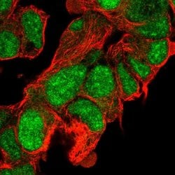 Invitrogen CLASRP Polyclonal Antibody 100 &mu;L; Unconjugated:Antibodies,