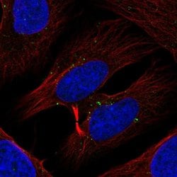 Invitrogen TXK Polyclonal Antibody 100 &mu;L; Unconjugated:Antibodies,