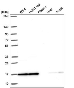 Invitrogen NCBP2 Polyclonal Antibody 100 &mu;L | Buy Online | Invitrogen&trade; | Fisher Scientific