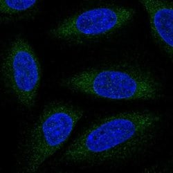 Invitrogen ALG6 Polyclonal Antibody 100 &mu;L; Unconjugated:Antibodies,