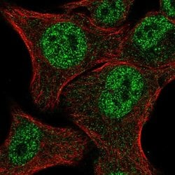 Invitrogen MBNL2 Polyclonal Antibody 100 &mu;L; Unconjugated:Antibodies,